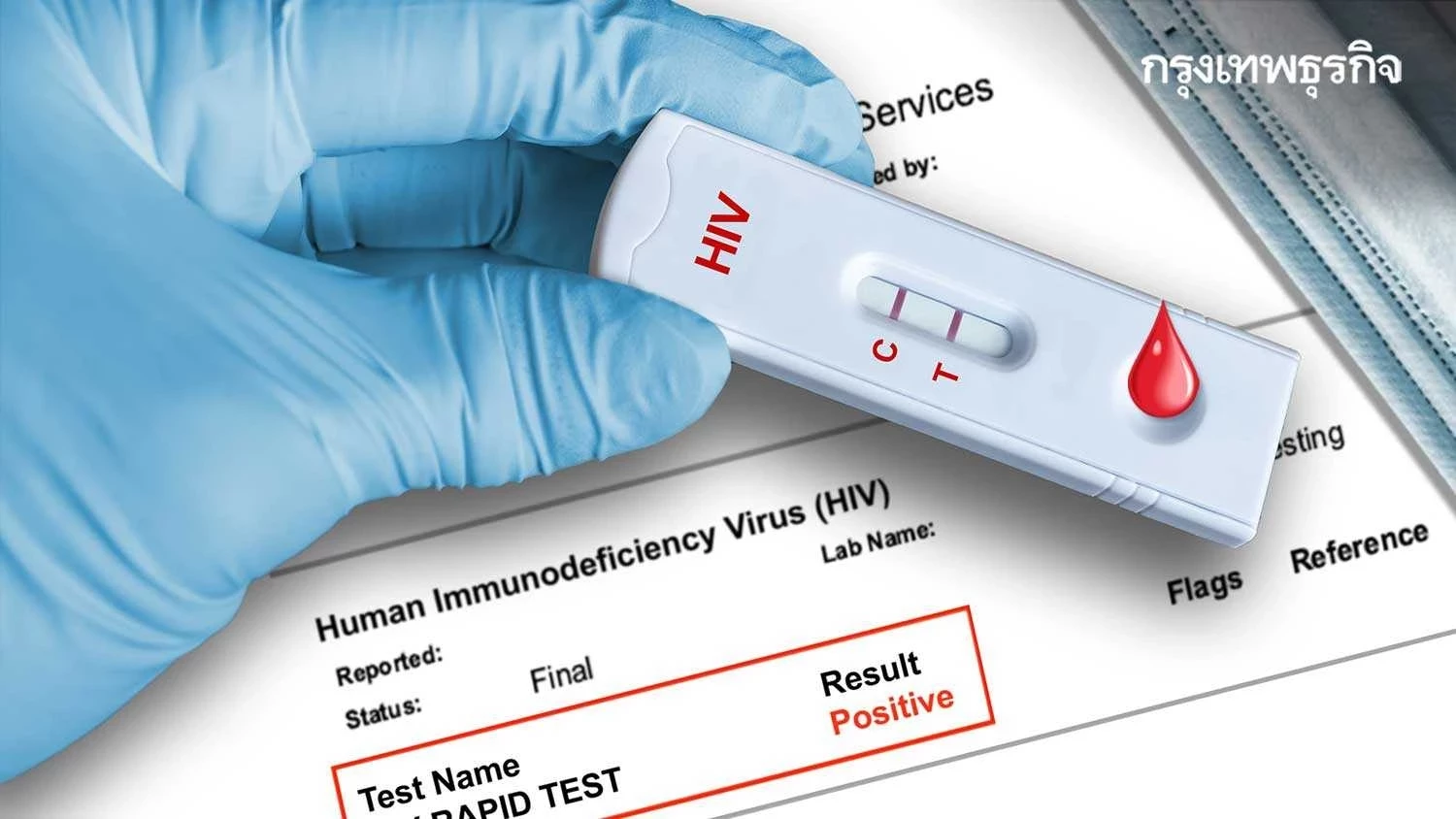 'ดราม่า HIV' ระวังOne Night Stand ความเชื่อผิดๆ เกี่ยวกับโรค