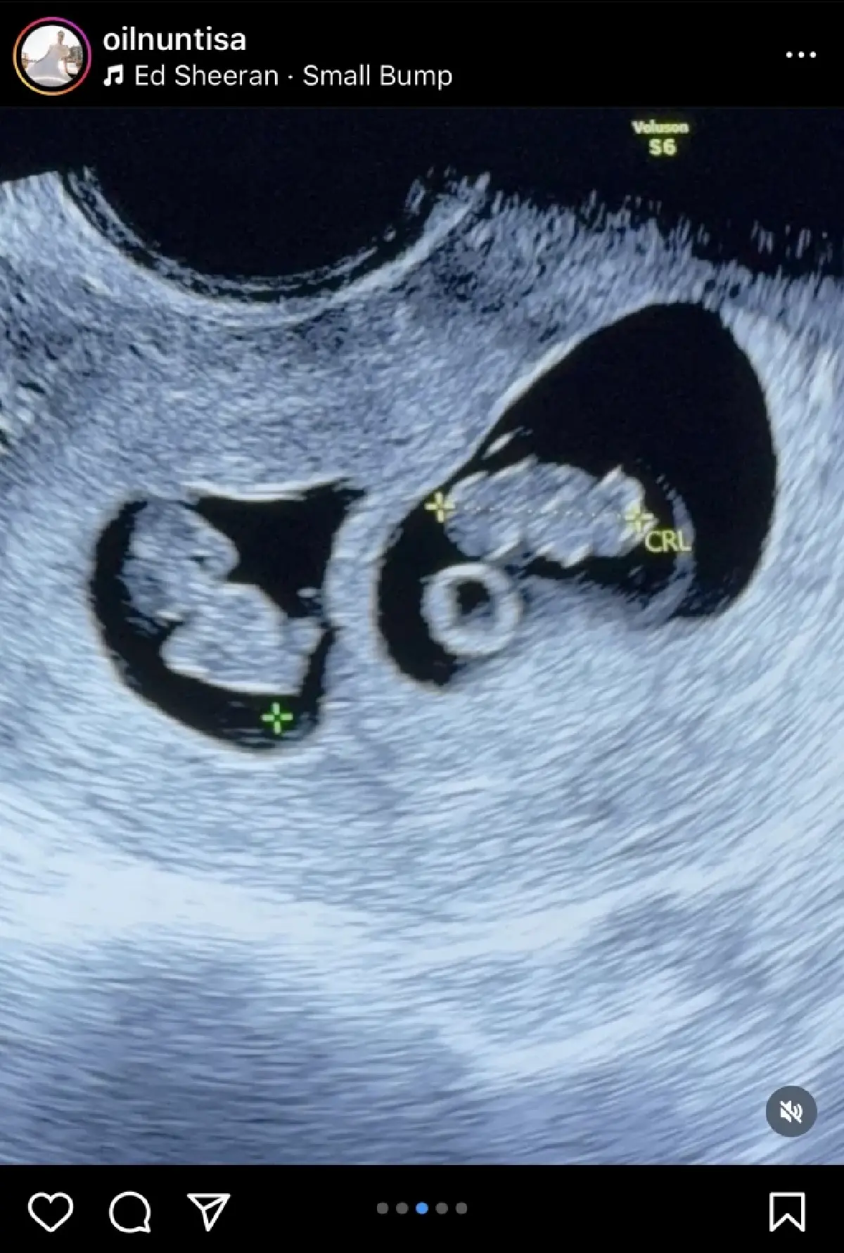 ‘ต๊อบ อัยยวัฒน์’ เจ้าสัว ‘คิง เพาเวอร์’ เตรียมอุ้มลูกแฝด ข่าวดีรับสงกรานต์!