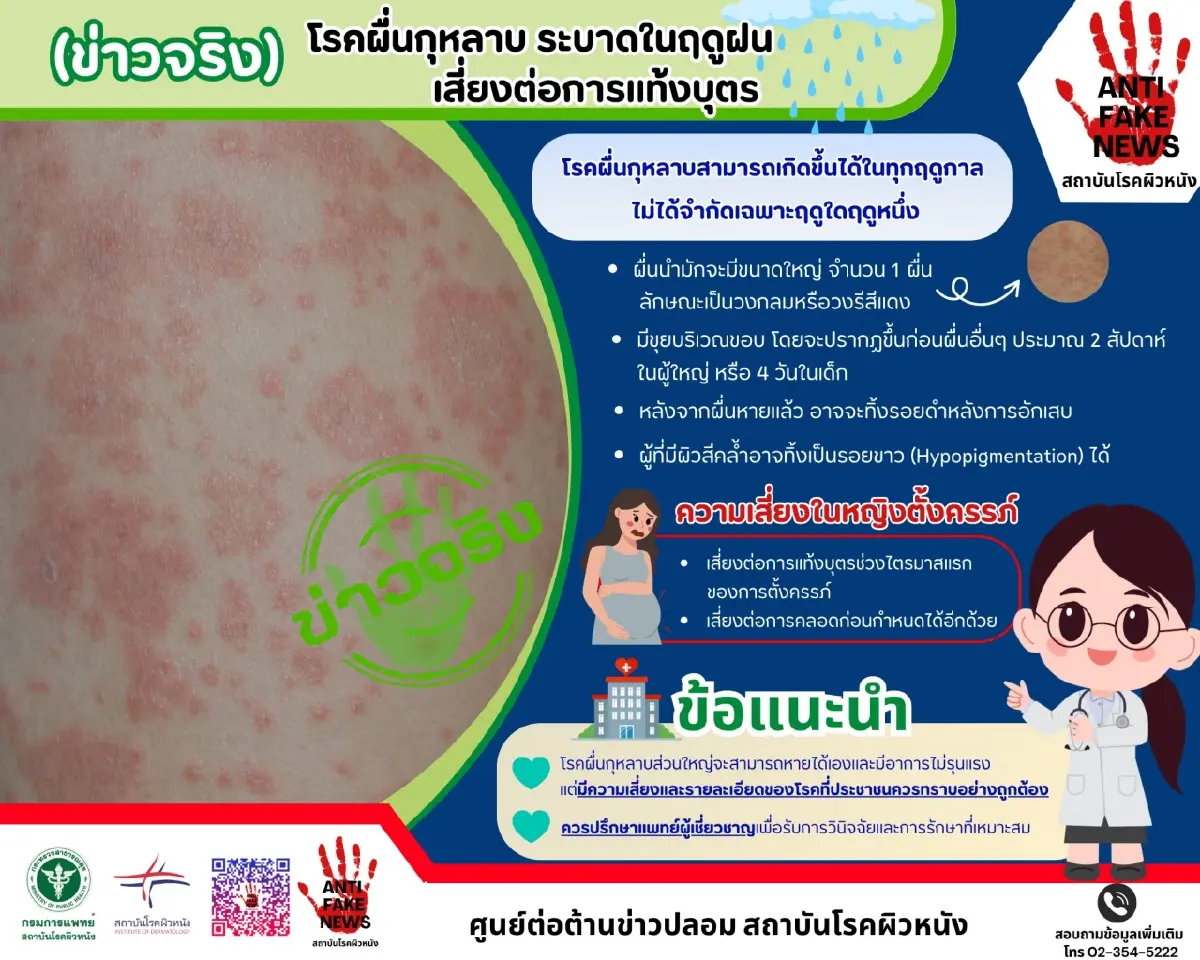 'โรคผื่นกุหลาบ' ไม่ใช่ผื่นคันธรรมดา เสี่ยงแท้งลูก คลอดก่อนกำหนด