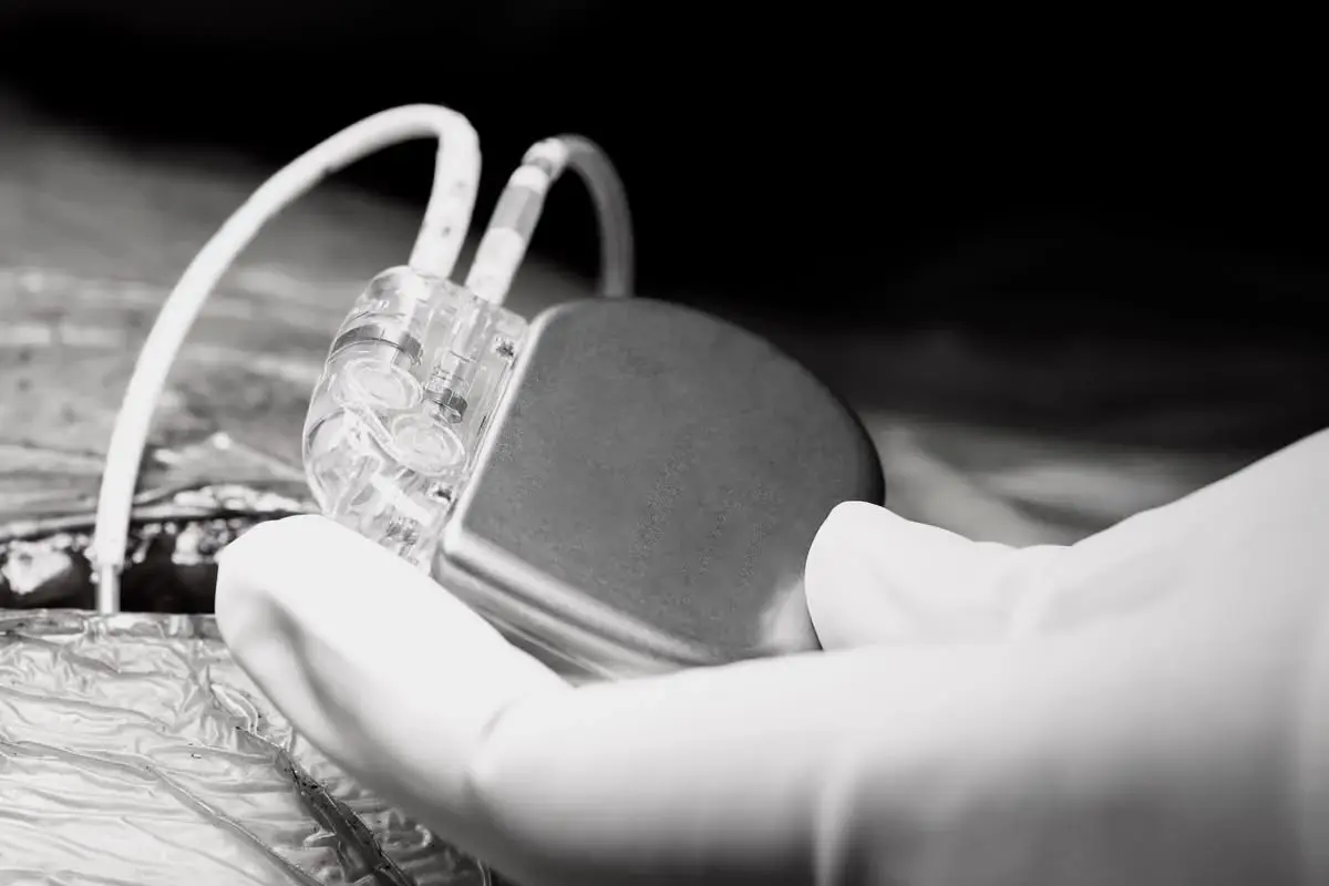 รพ.จุฬาฯ สร้างประวัติศาสตร์! ผ่าตัดรักษา โรคหยุดหายใจขณะหลับ สำเร็จ