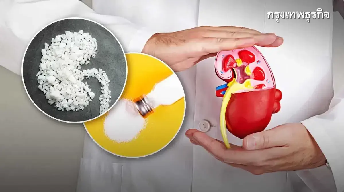 สัญญาณเตือนภัย 'ป่วยเงียบ' กินโซเดียมเกินขนาด อาการเป็นยังไง?