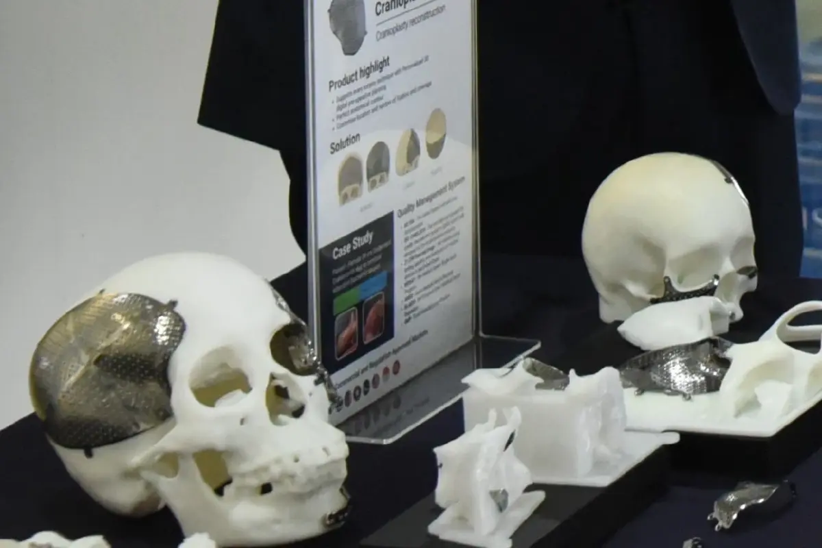 'นวัตกรรมวิศวะจุฬาฯ'  ลดนำเข้าอุปกรณ์ทางการแพทย์-ราคาที่จับต้องได้