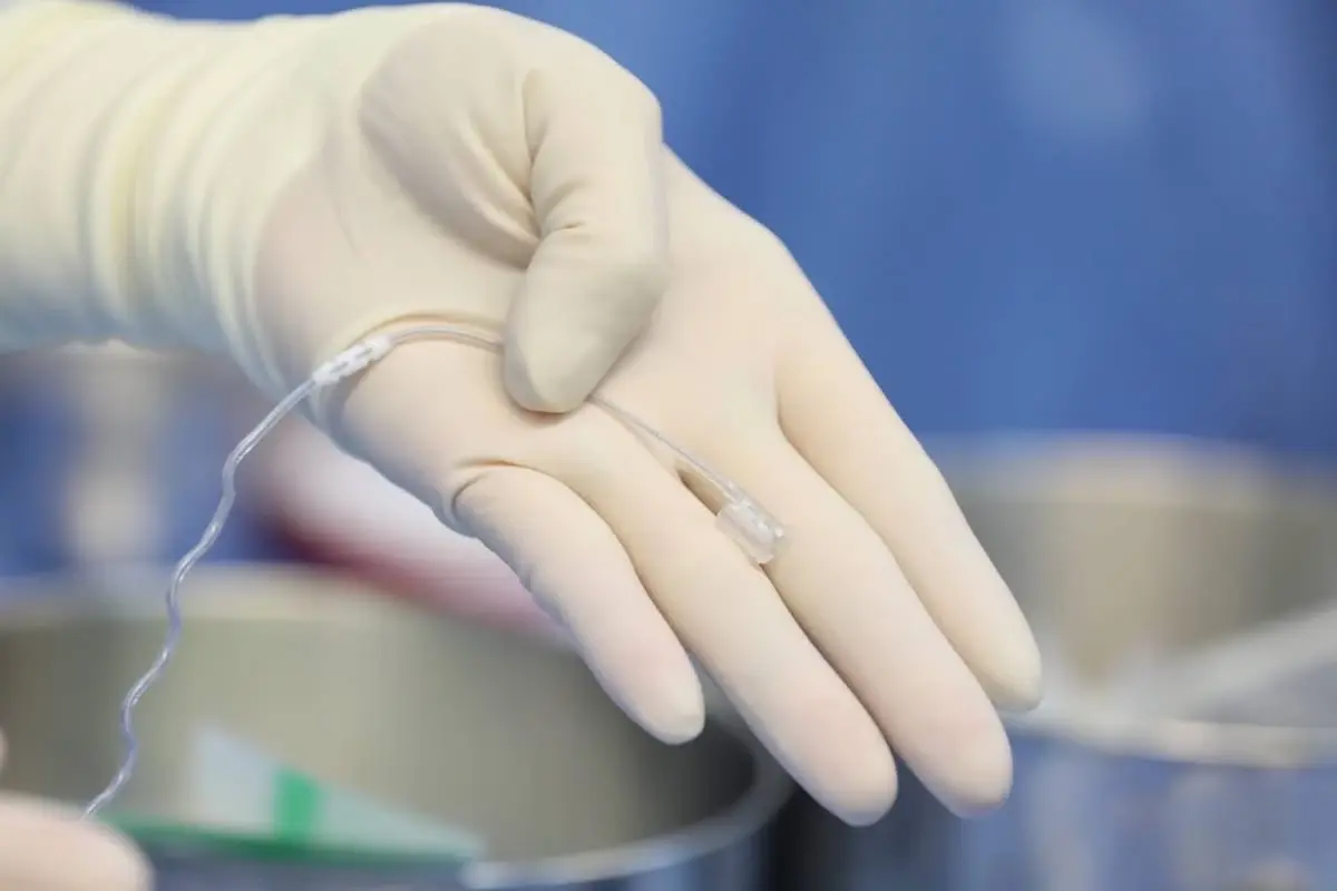 รพ.จุฬาฯ สร้างประวัติศาสตร์! ผ่าตัดรักษา โรคหยุดหายใจขณะหลับ สำเร็จ