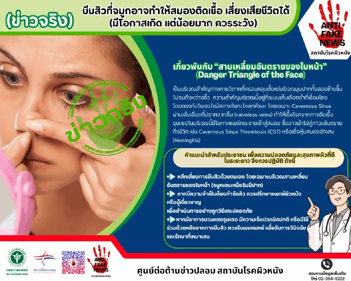 เป็นเรื่อง คนชอบกดสิว บีบสิวที่จมูก เสี่ยงสมองติดเชื้อ เสียชีวิต