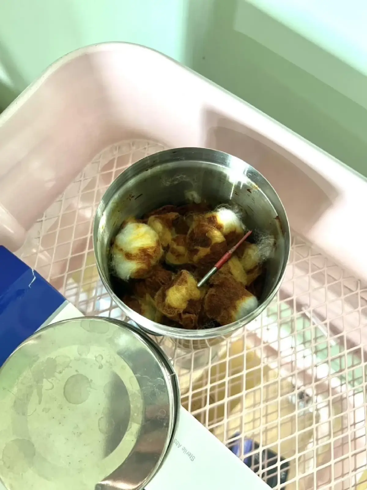 บุกคลินิกดังไร้แพทย์ อันตรายศัลยกรรมทำสวย ฉีดเพิ่มขนาดเจ้าโลก