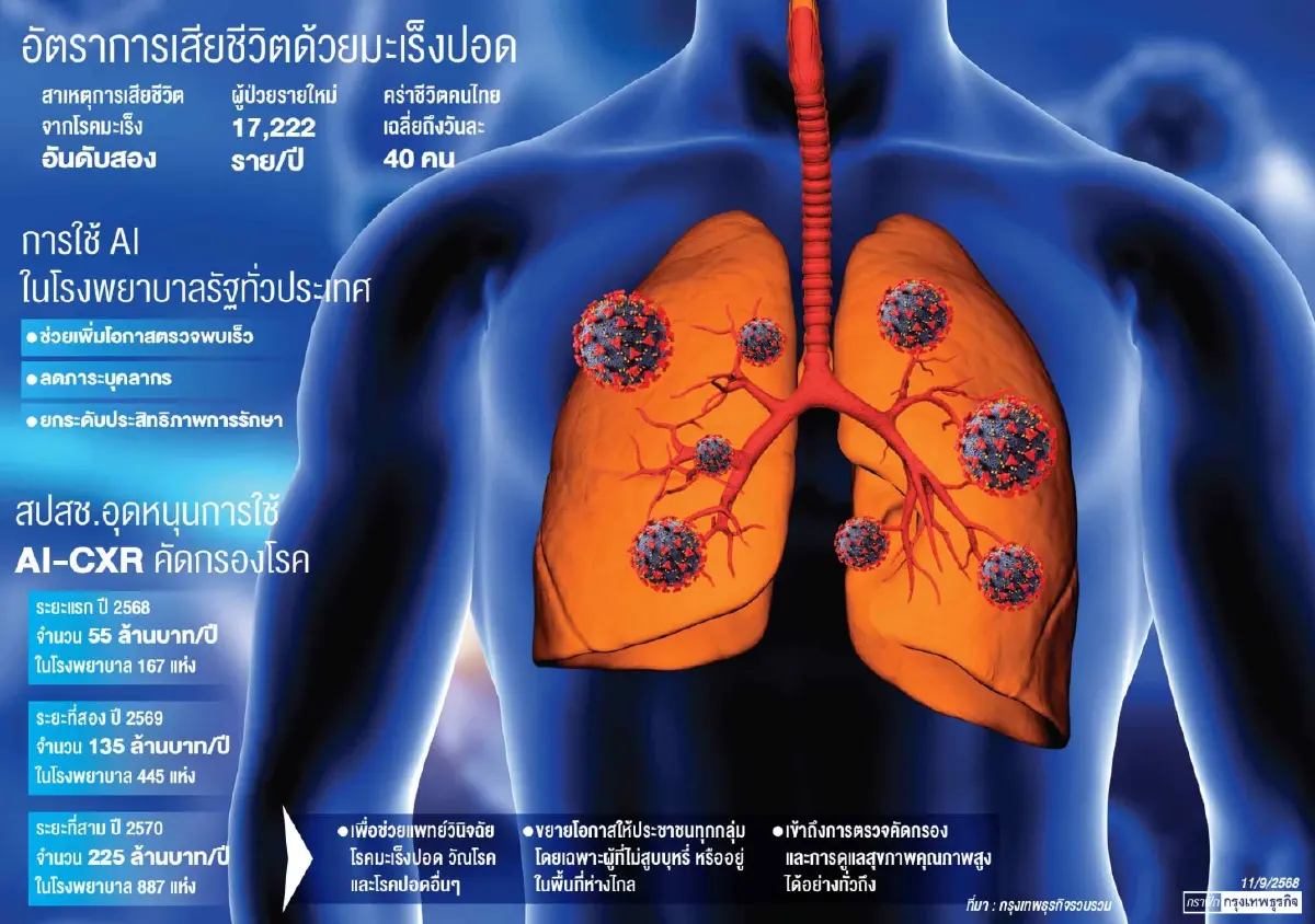 'คัดกรองมะเร็งปอด'ด้วย AI  นวัตกรรมสุขภาพทุกคนเข้าถึง