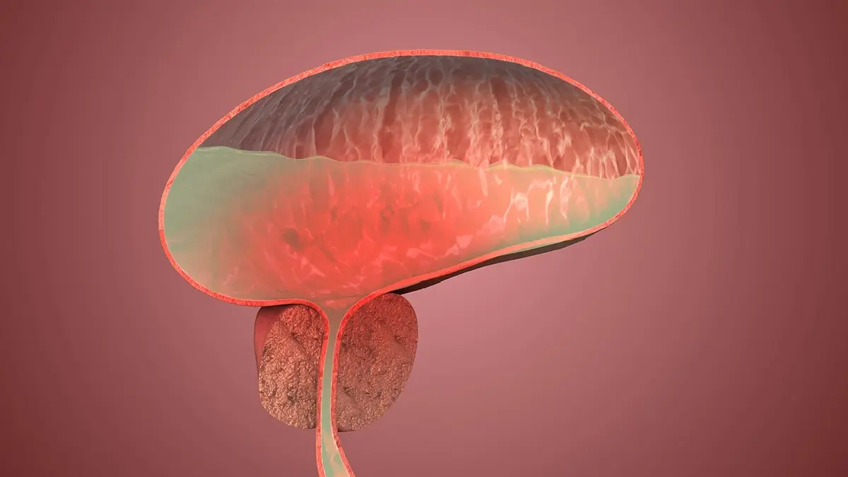 วิจัยจุฬาฯ! 'พืชสกุลพลับพลึง – กระชายดำ' ยับยั้งเสี่ยงต่อมลูกหมากโต