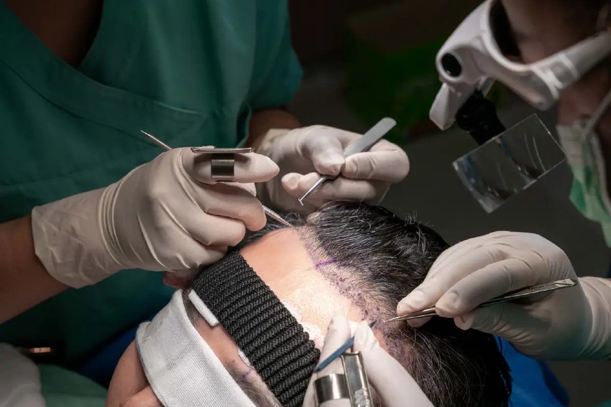 บอกลาผมร่วง-หัวล้าน! 'ศูนย์ปลูกถ่ายเส้นผม เมดพาร์ค' แก้ทุกโจทย์ปัญหา