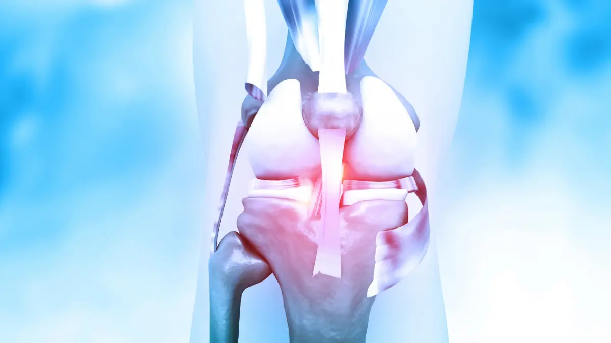 เจาะลึกเทคนิครักษา 'ข้อเข่าเสื่อม' กับ 'แพทย์เฉพาะทาง'