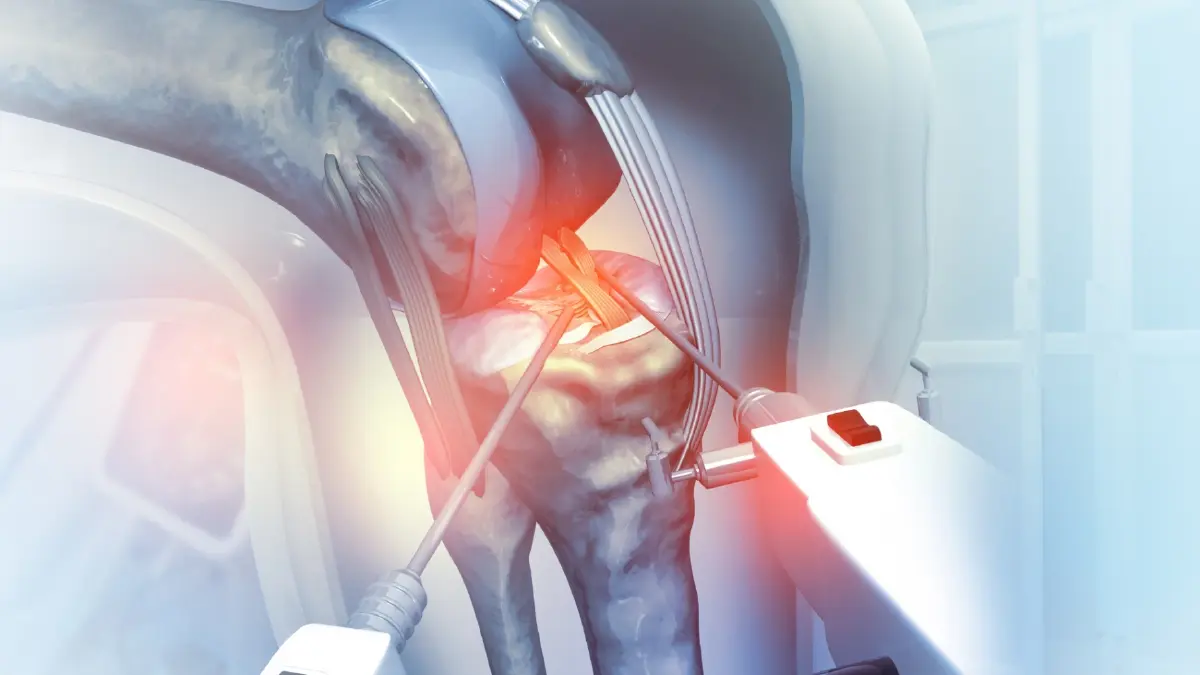 เจาะลึกเทคนิครักษา 'ข้อเข่าเสื่อม' กับ 'แพทย์เฉพาะทาง'