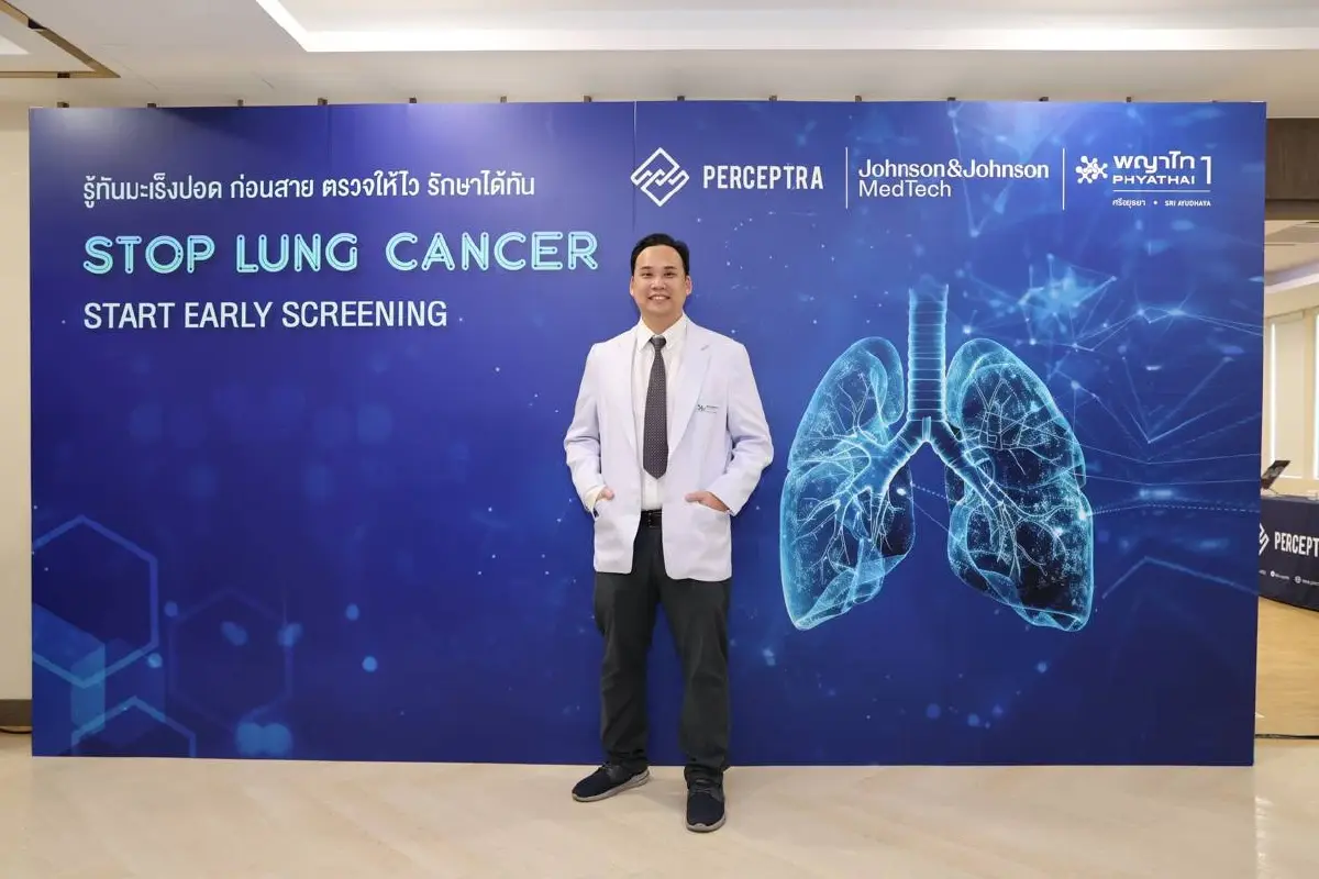พบผู้ป่วยมะเร็งปอด ระยะลุกลาม 70% แนะตรวจคัดกรอง รู้เร็ว รักษาหาย