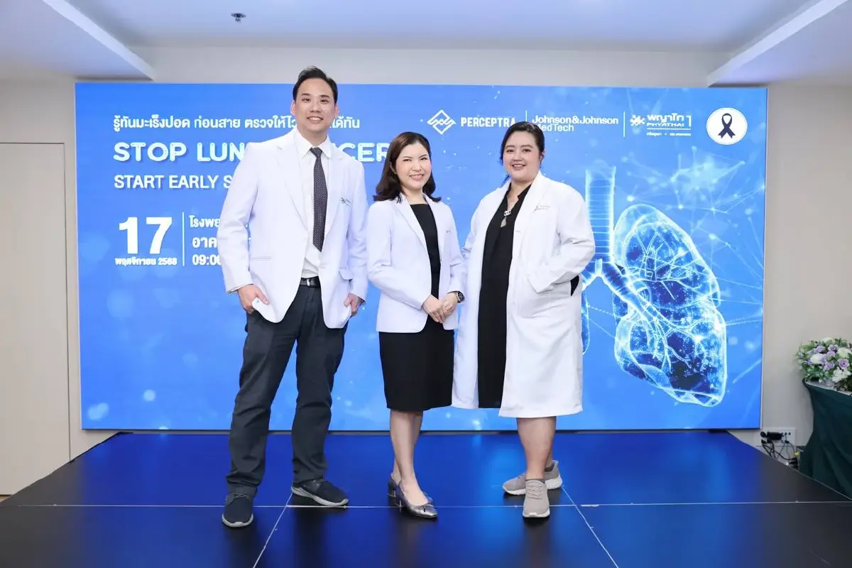 พบผู้ป่วยมะเร็งปอด ระยะลุกลาม 70% แนะตรวจคัดกรอง รู้เร็ว รักษาหาย