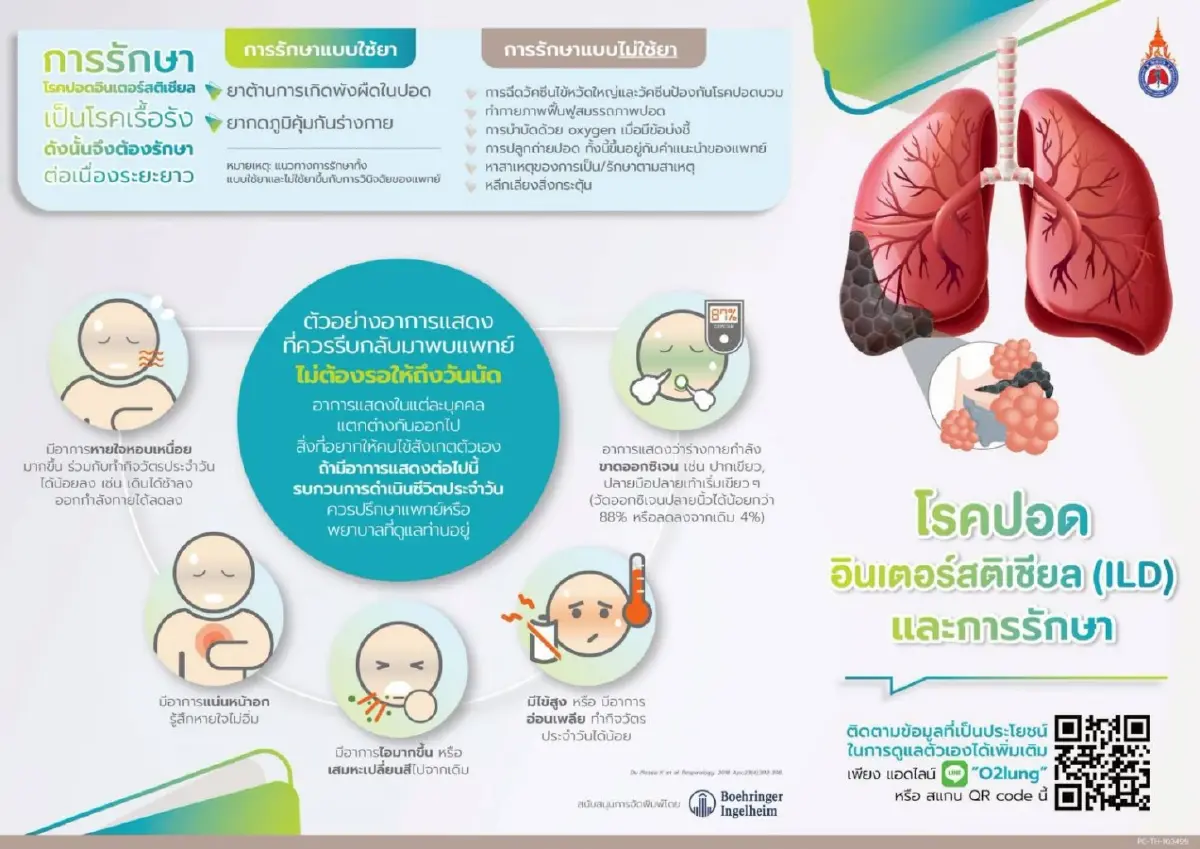 ‘HRCT Checklist’ ดิจิทัล ติดอาวุธรังสีแพทย์ – แพทย์ สู้ 'โรคไอแอลดี'