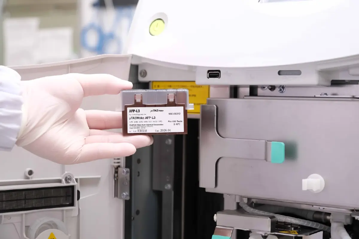 ฟูจิฟิล์ม ยกระดับคัดกรอง 'มะเร็งตับ' ด้วย 'GALAD Score' ครั้งแรก ที่ รพ.หนองคาย