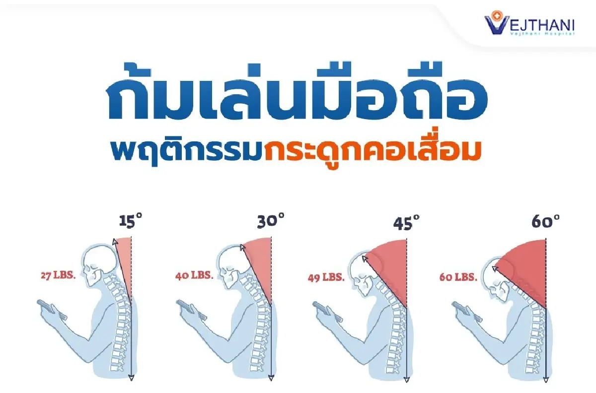 ‘ก้มหน้าเล่นมือถือ’ 60 องศา เท่ากับแบกข้าวสาร 27 กก.ตลอดเวลา