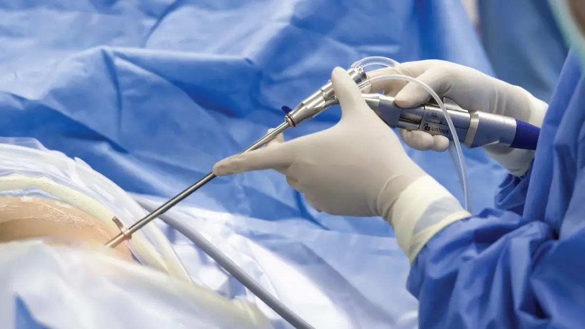 กระดูกสันหลัง ไม่แก่ก็เสี่ยง ‘MIS’ นอนโรงพยาบาลคืนเดียว กลับบ้านได้