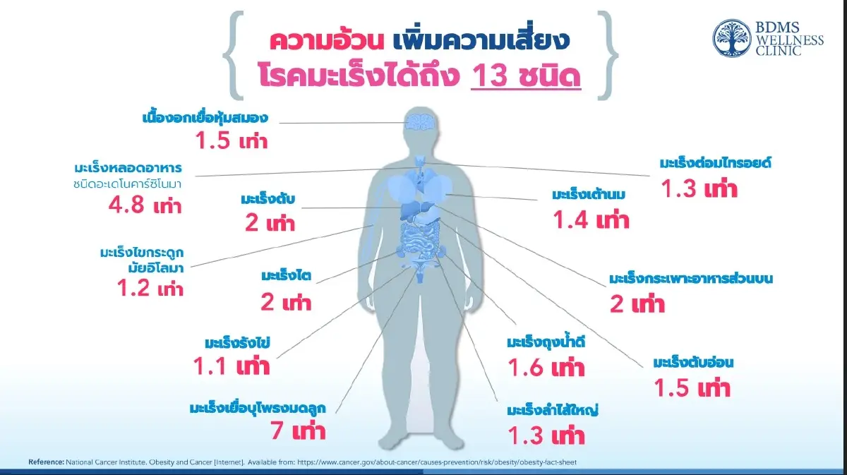 ‘ความอ้วน’ เพิ่มเสี่ยง ‘โรคมะเร็ง’ 13 ชนิด ชูพืชผักพื้นบ้านต้านอนุมูลอิสระ