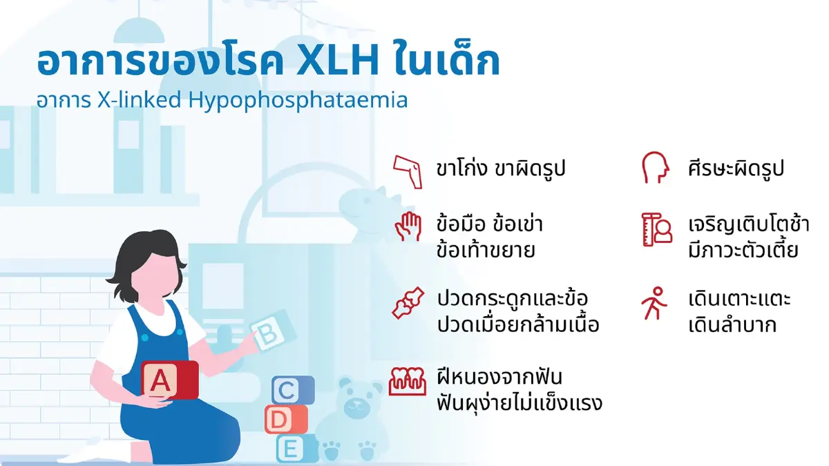 4 องค์กรผนึกกำลัง ยกระดับการรักษา XLH พลิกชีวิตผู้ป่วยโรคหายากในไทย