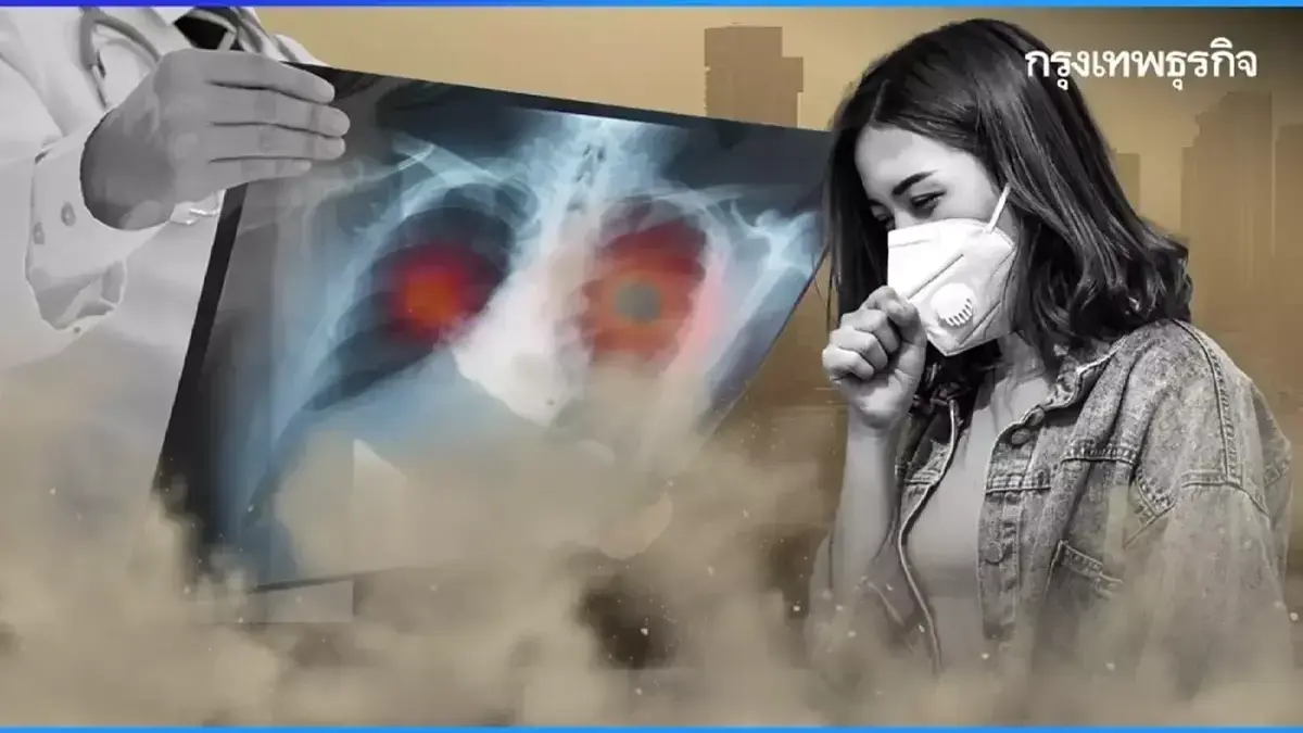 แพทย์เตือน อันตรายค่าฝุ่นสูง PM 2.5 เป็นปัจจัยกระตุ้น 'มะเร็งปอด'