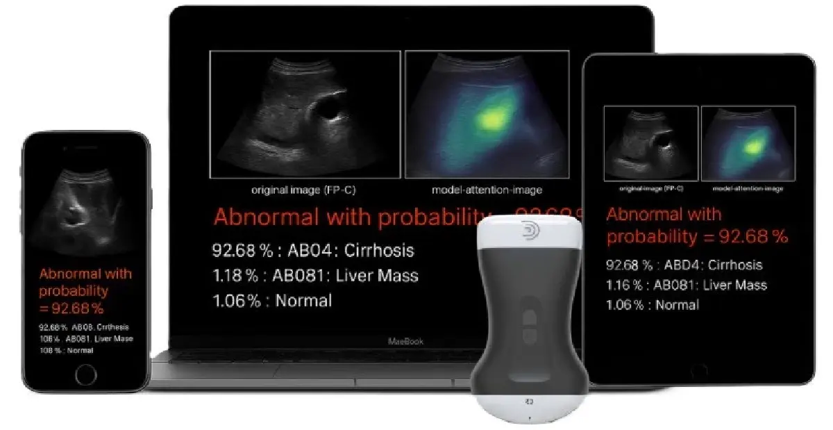 SPEAR H ดันเฮลท์เทคสตาร์ตอัปไทย  สู่เชิงพาณิชย์รับเมกะเทรนด์สุขภาพโต25%