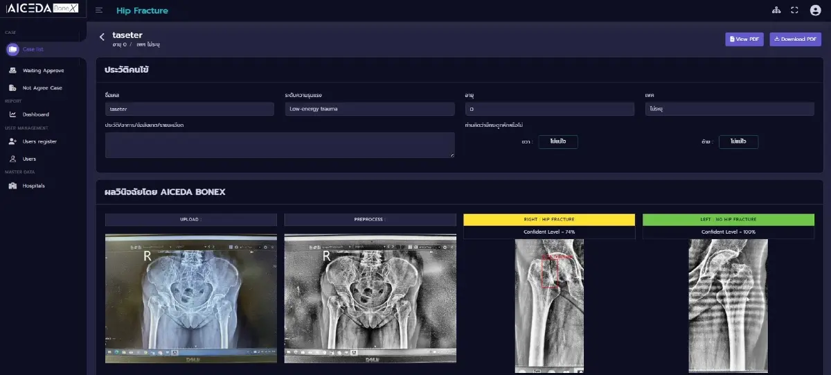 SPEAR H ดันเฮลท์เทคสตาร์ตอัปไทย  สู่เชิงพาณิชย์รับเมกะเทรนด์สุขภาพโต25%