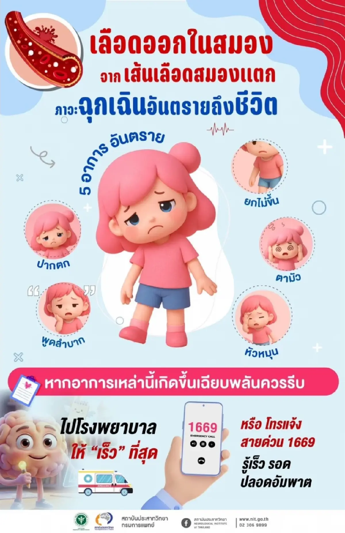 กรมการแพทย์ แนะสังเกตุ 5 อาการ เลือดออกในสมองจากเส้นเลือดสมองแตก