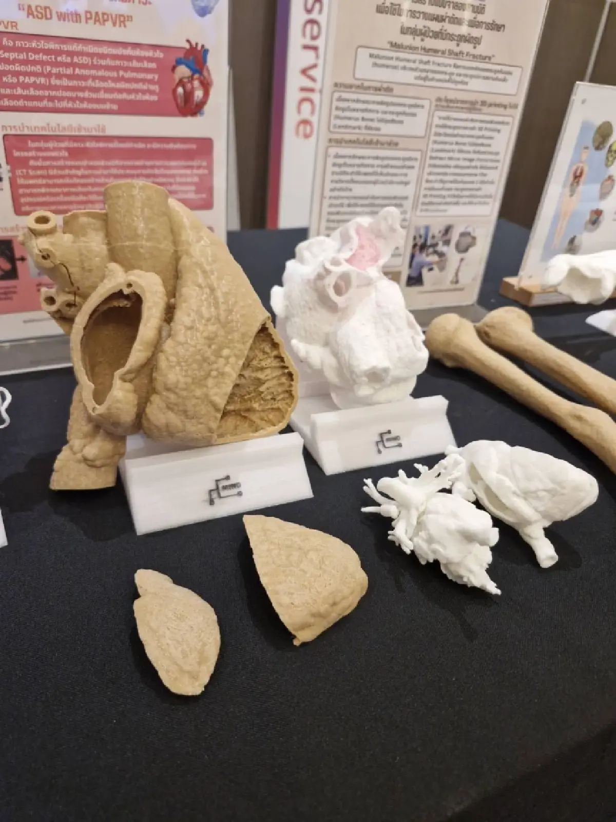 'Osscentric Medical Sandbox' เชื่อมแพทย์-วิศวะ ดัน MedTech ไทยโตสากล