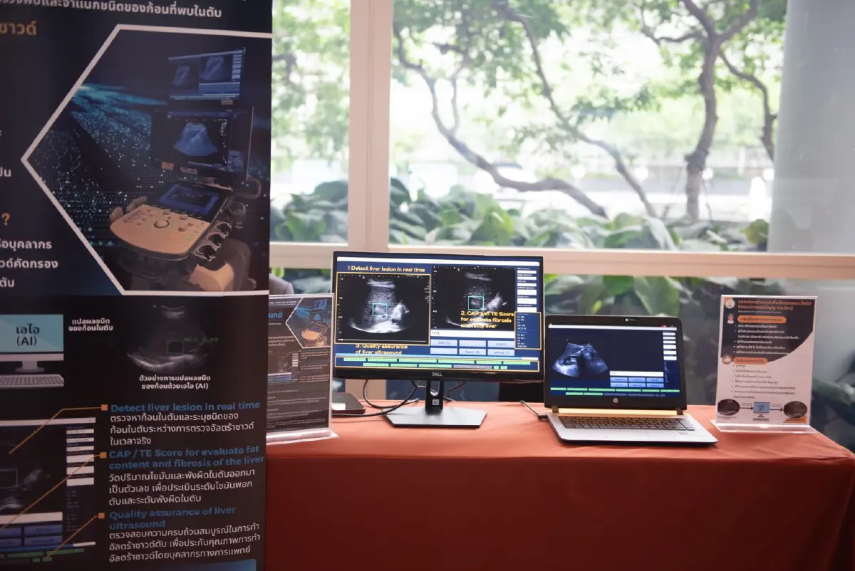 ‘Medical AI Platform’ ดันนวัตกรรมสุขภาพ ขับเคลื่อน Wellness Thailand