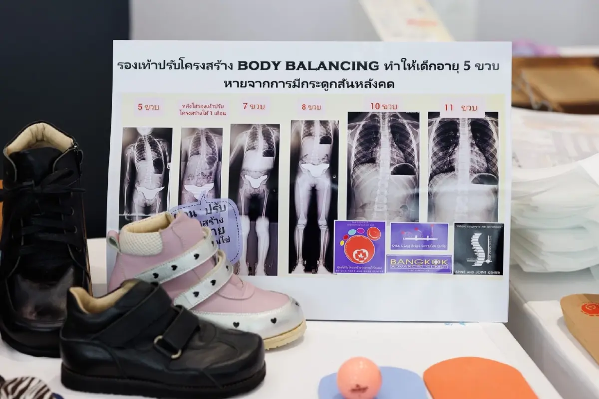 ภัยเงียบ 'โครงสร้างร่างกายผิดสมดุล'ต้นเหตุปวดหลัง เข่าเสื่อม ปวดเรื้อรัง
