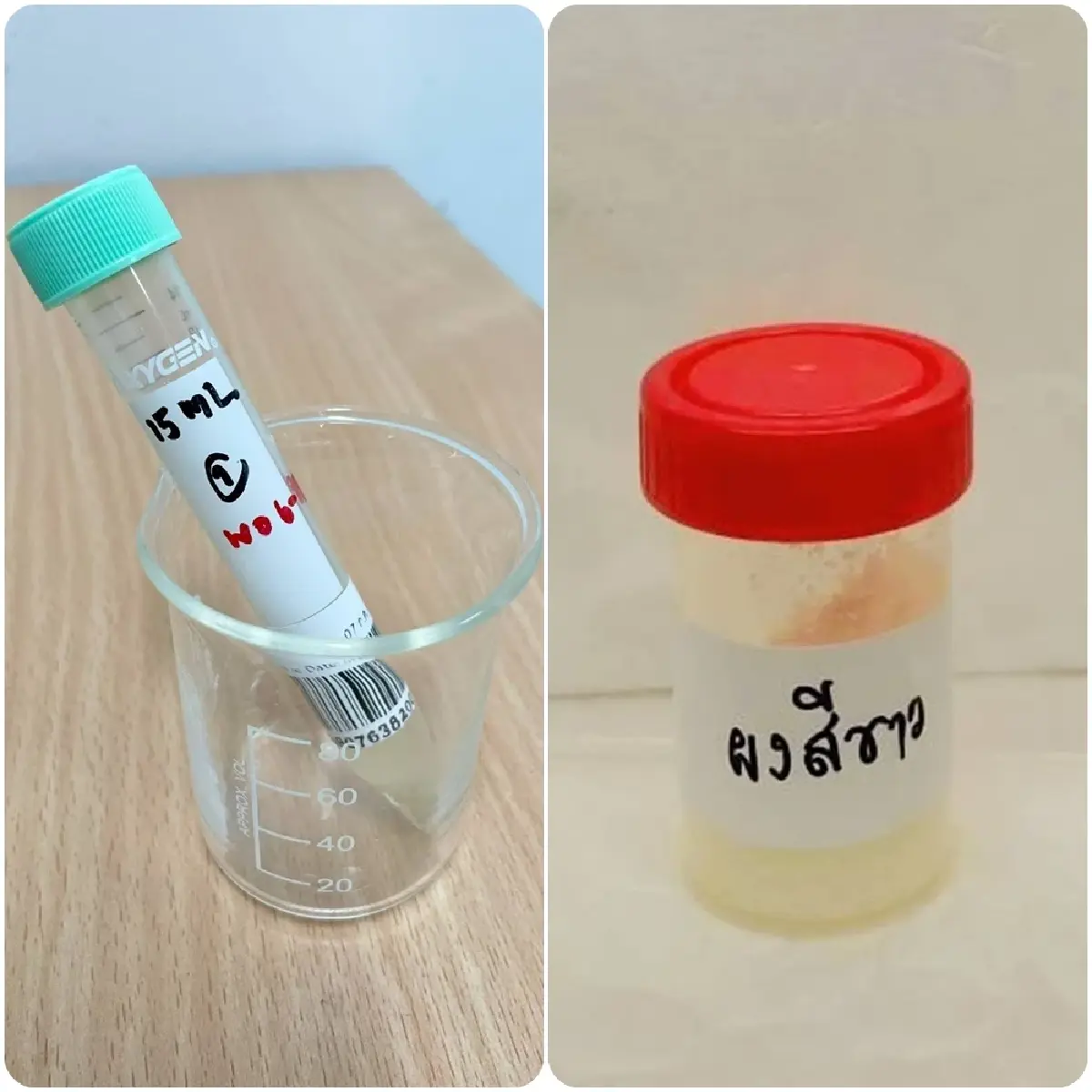 กรมวิทย์ฯ เฉลย 'ผงสีขาว' ในก๋วยเตี๋ยวอุดรคืออะไร ทำไมกินแล้วงทรุด