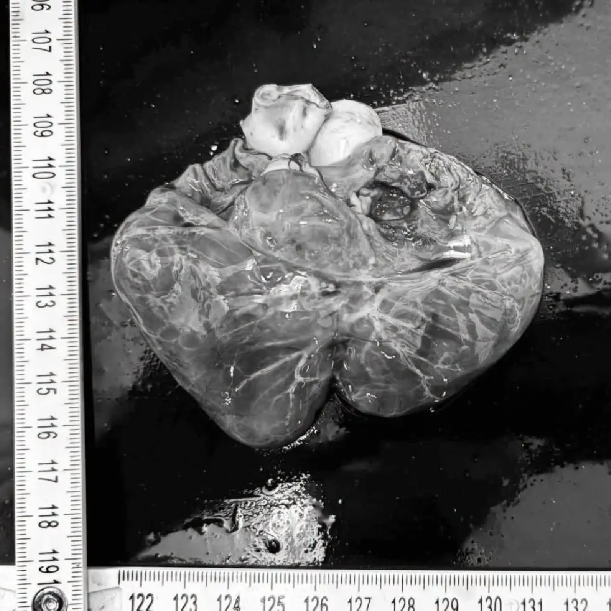 เปิดผลชันสูตร พะยูนเกยตื้น หลงฝูง ระนอง ระบบไหลเวียนเลือดล้มเหลว
