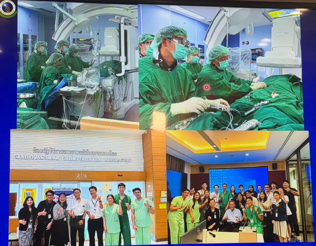 ศิริราช เปิดตัวนวัตกรรมรักษาลิ่มเลือดอุดกั้นปอดเรื้อรัง สำเร็จแล้ว 23 ราย