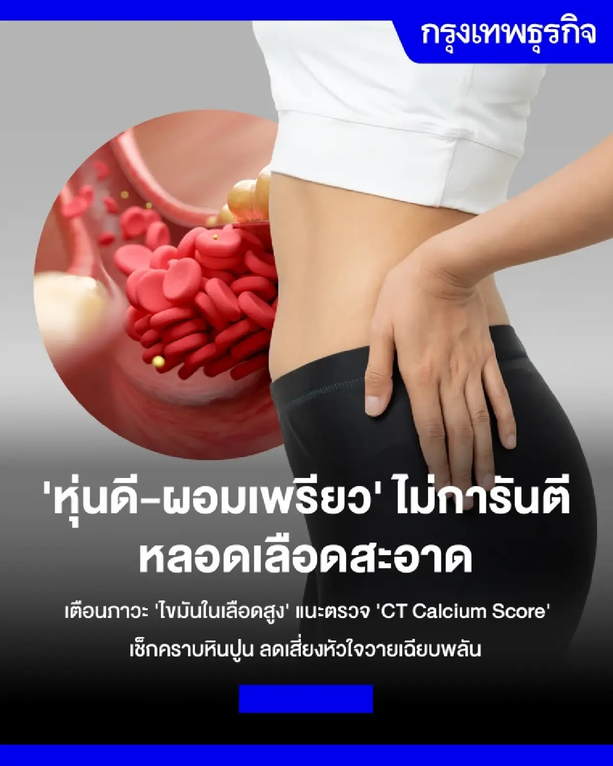 'ไขมันในเลือด'ไม่เลือกไซส์ ผอม-อ้วน เสี่ยงหมด แนะเช็ก 'CT Calcium Score'