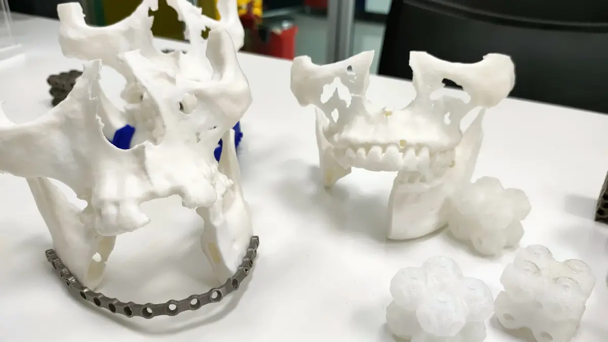 นวัตกรรมกู้ชีวิต 'AI-3D Printing' เปลี่ยนการรอ ให้กลายเป็นโอกาสรอด