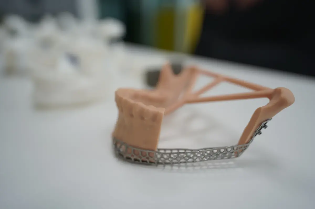 นวัตกรรมกู้ชีวิต 'AI-3D Printing' เปลี่ยนการรอ ให้กลายเป็นโอกาสรอด