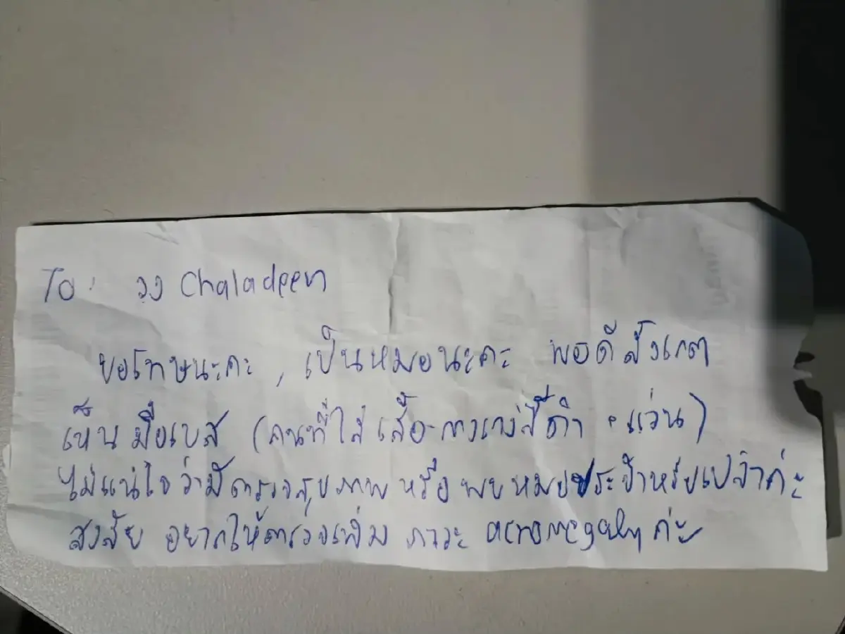 ‘อะโครเมกาลี’ โรคหายากเจอน้อยกว่า 5 ใน 10,000 ราย  ในเด็กเรียก ‘ภาวะยักษ์’