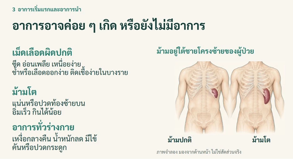 'เหนื่อยง่าย ซีด แน่นท้อง' อาการที่อาจไม่ธรรมดา รู้จักโรค MFมะเร็งชนิดหายาก
