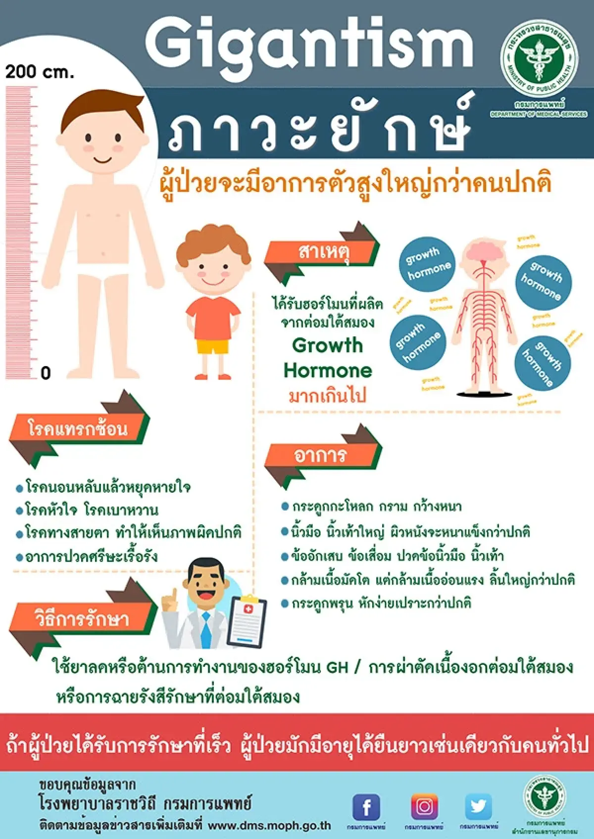 ‘อะโครเมกาลี’ โรคหายากเจอน้อยกว่า 5 ใน 10,000 ราย  ในเด็กเรียก ‘ภาวะยักษ์’