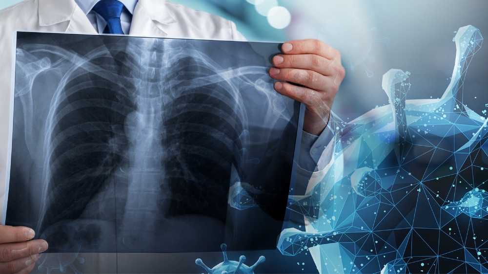 ศบค. เผย 7 วันหลัง ปรับมาตรการ ป่วยโควิด อาการหนัก แนวโน้มลดลง