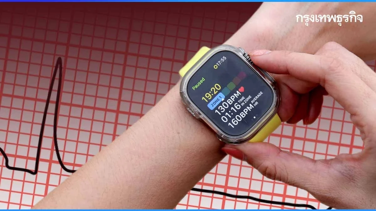 รอดตายเพราะ Apple Watch! หญิงอเมริกันโกงความตายเพราะ "Apple Watch" เตือน