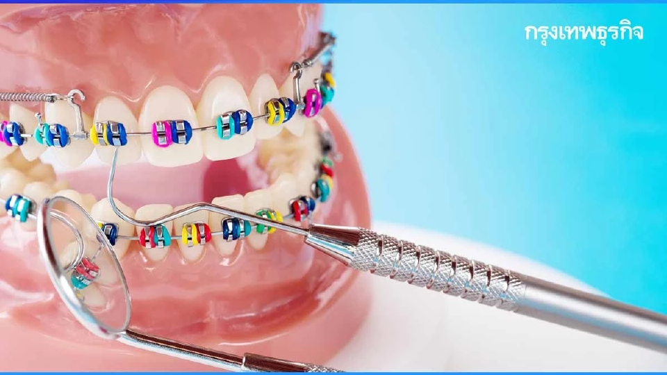 เสี่ยงติดเชื้อ! อันตรายถึงตาย แพทย์เตือนจัดฟันแฟชั่นหมอเถื่อน