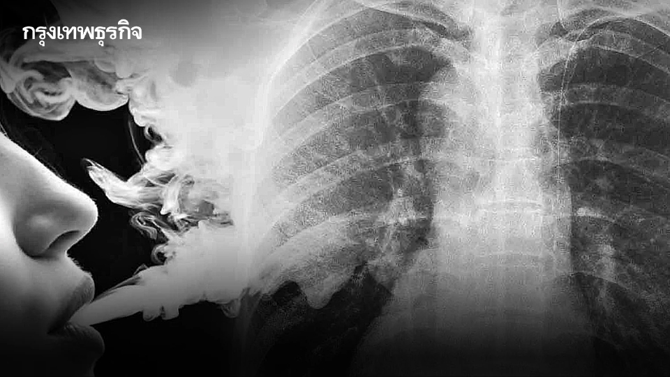 เตือนภัย บุหรี่ไฟฟ้า แบบใหม่ระบาด สถิติ ปี67 เยาวชนป่วย ปอดอักเสบ กว่า 100 ราย