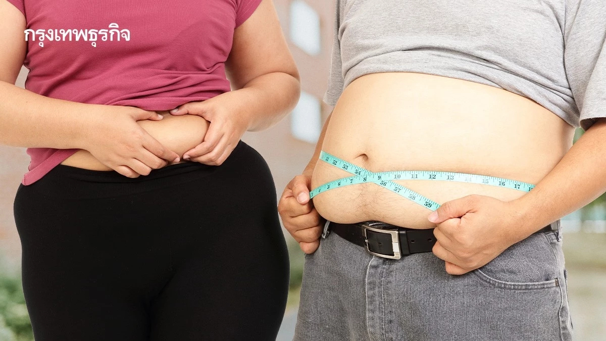 'วันอ้วนโลก' เกือบ 1 พันล้านคนเผชิญโรคอ้วน แนะปรับ 5 พฤติกรรมเสี่ยง