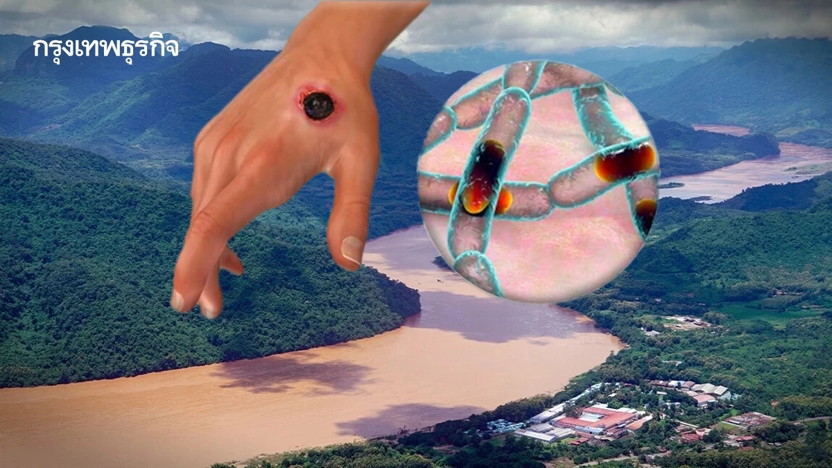 แกะรอย ‘โรคแอนแทรกซ์’ เข้าไทย ขุดถึง ‘ไขกระดูก’ ลอยตามแม่น้ำโขง?