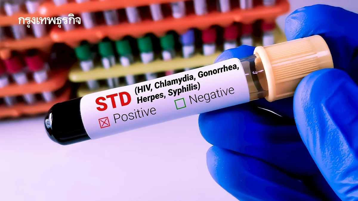 เตือน 'ซิฟิลิส-หนองใน' ระบาด 5 จังหวัดน่าห่วง ยอดผู้ป่วยเพิ่มขึ้น