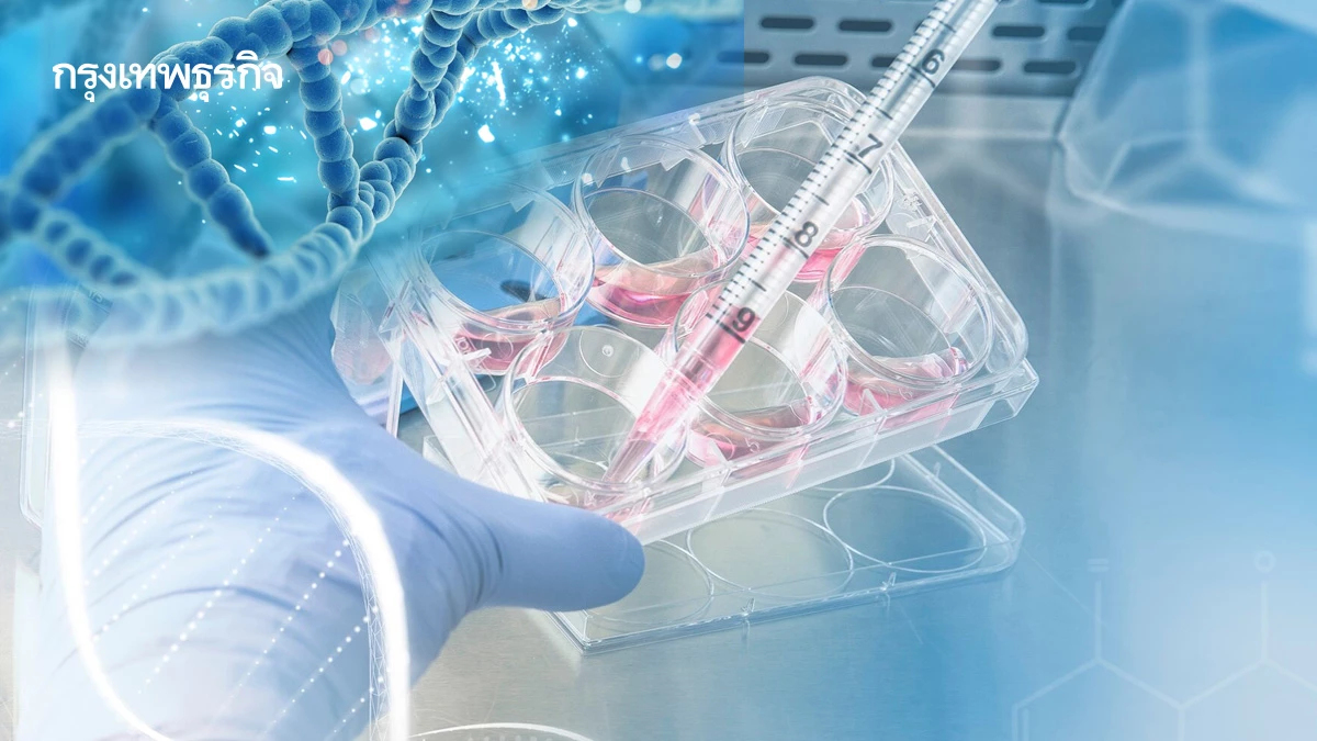 รพ.ราชวิถีปลูกถ่ายเซลล์ต้นกำเนิด ชายวัย60ปี สำเร็จเป็นรายแรก