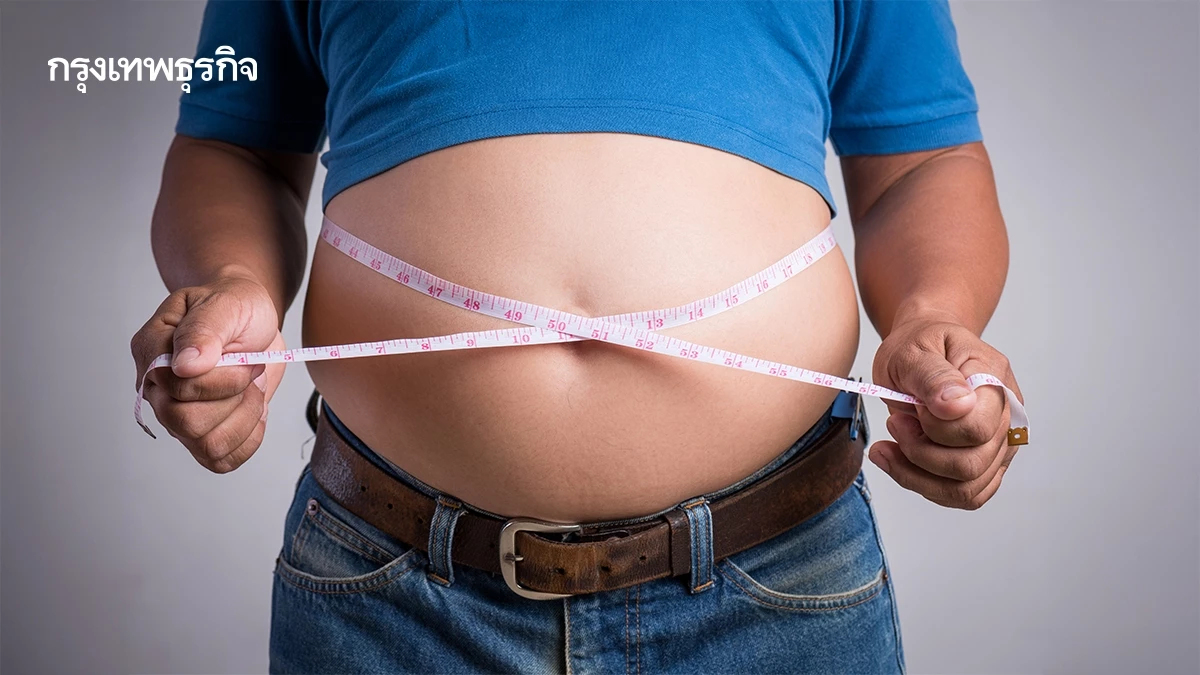 ทางรอด 'โรคอ้วน' แพทย์รวมตัว แชร์องค์ความรู้รักษาแบบยั่งยืน