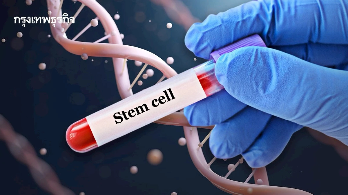 'สเต็มเซลล์รักษาโรค' ไม่ควรหลงเชื่อ ก่อนรู้เรื่องจริงให้ครบ