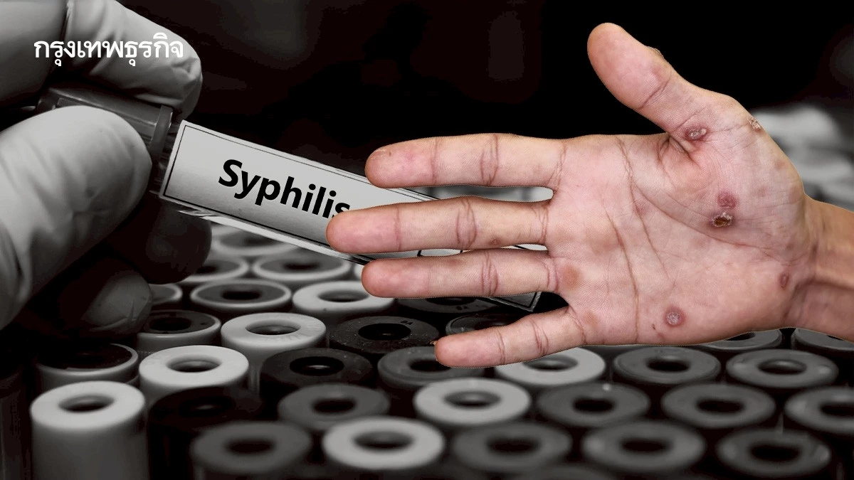 เซฟตัวเอง! วัยรุ่นไทยท้องลด แต่ติดโรคพุ่ง เช็ก 5 โรคทางเพศยอดฮิต