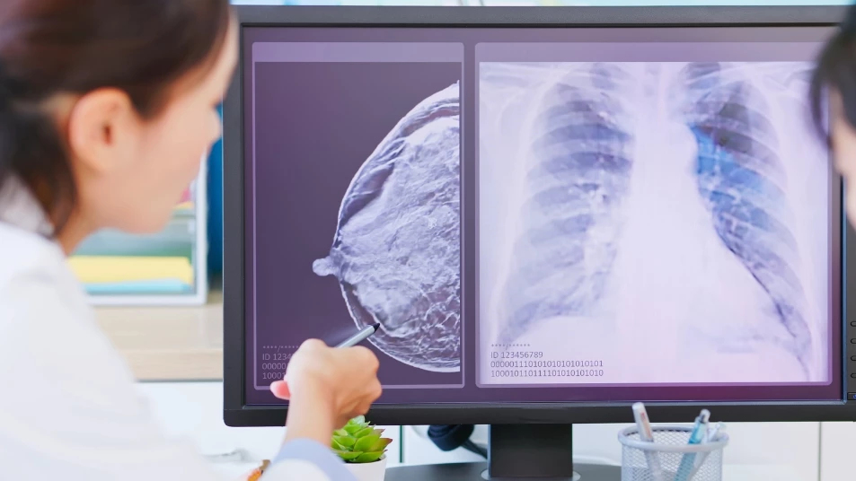 โรช ไทยแลนด์ พลังเสียงกู้ชีพ! ฉลองเดือนผู้รอดชีวิตจากมะเร็ง